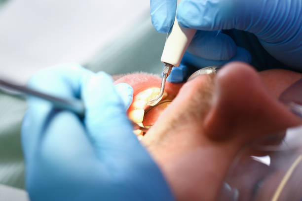 Best Pediatric Emergency Dentist in Silver Lake, NC