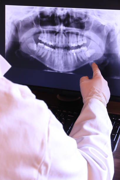 Best Emergency Treatment for Dental Infections or Abscesses in Silver Lake, NC