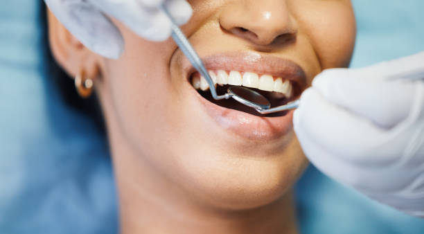 Best Cosmetic Emergency Dentistry in Silver Lake, NC