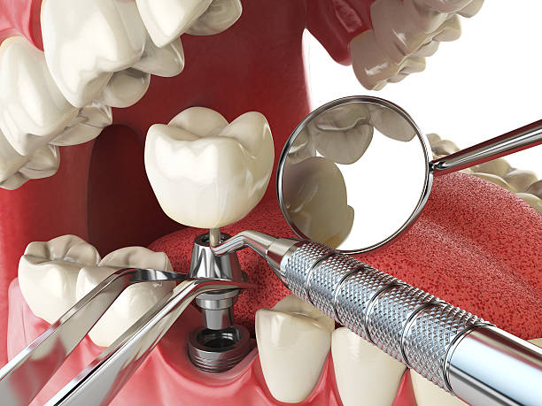 Best Emergency Dental Care for Broken or Chipped Teeth in Silver Lake, NC